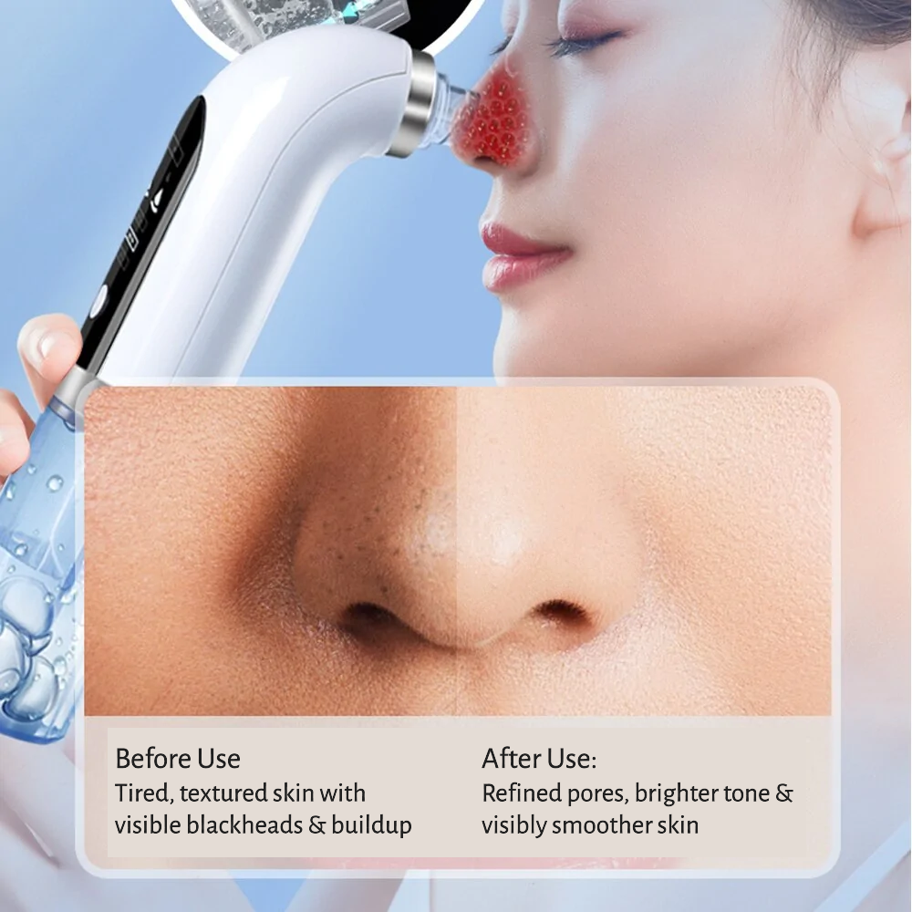 THE PORE ERASER™