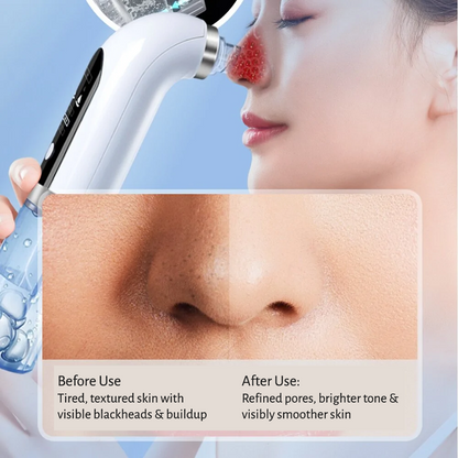 THE PORE ERASER™